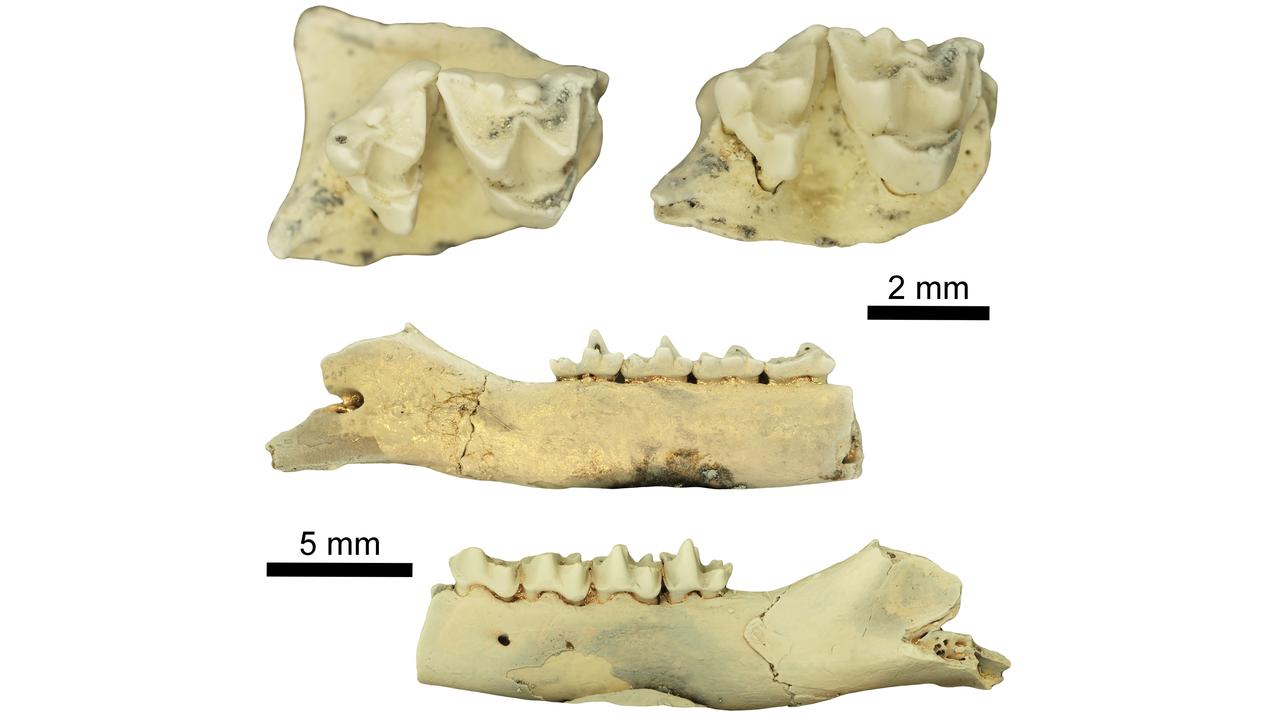 teeth 
