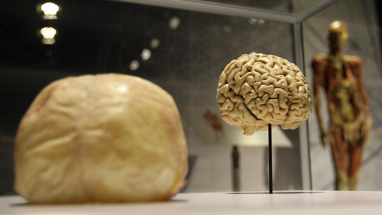 A human brain is seen at Real Bodies The Exhibition